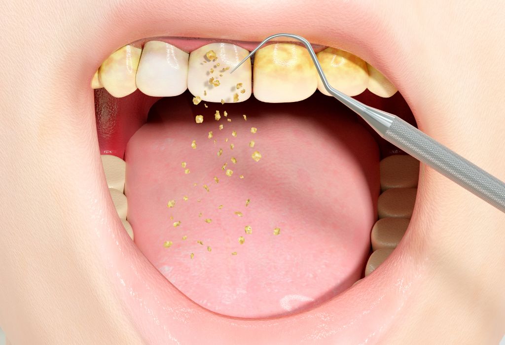 periodontologia
